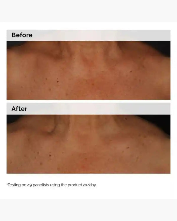 Niacinamide 5% Face and Body Emulsion 100ml