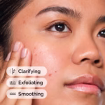 Salicylic Acid 2% Solution - Image 4