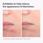 Salicylic Acid 2% Solution - Image 3